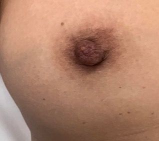 chris svircas add fat black nipple image