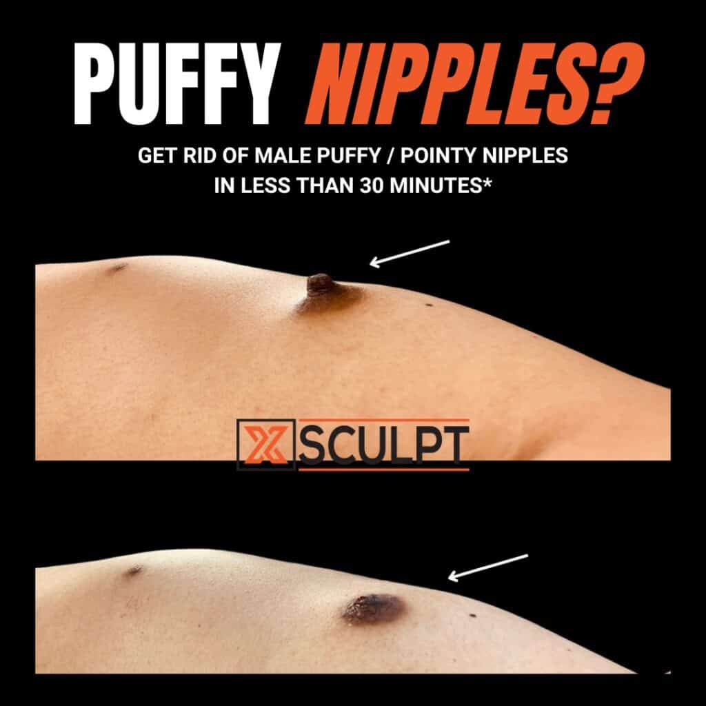 ak soni add puffy nipple tube photo